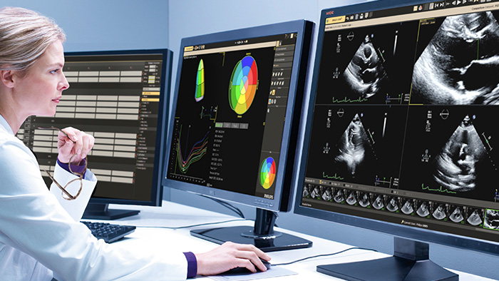 Ultrasound Workspace 超声影像解决方案